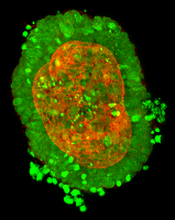 Cellesce colorectal tumour organoids imaged at the National Physical Laboratory using M Squared Lasers’ Aurora Airy Beam Light Sheet microscope system.