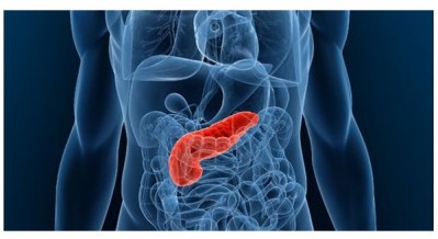 Chinese researchers develop nanocarrier for pancreatic cancer drug