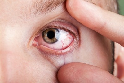 FDA demands product quality info in CRL for Shire's dry eye NDA