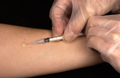 Mantoux tuberculin skin test (Picture: CDC Public Health Image Library)