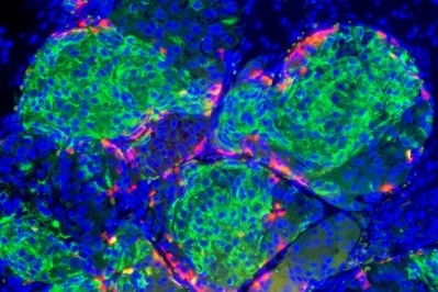 A photo of human beta cells, courtesy of Harvard