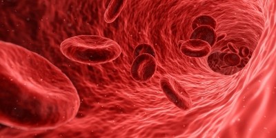 Modus raises more cash for Ph II trial of Sickle Cell drug 