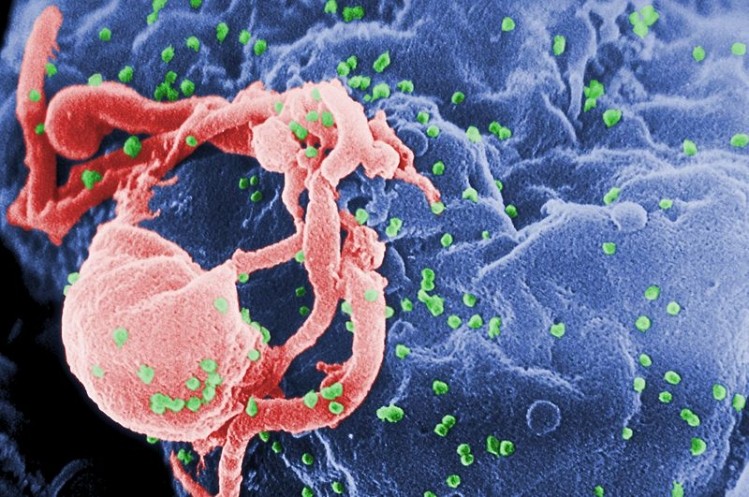 Intravaginal ring could help prevent HIV