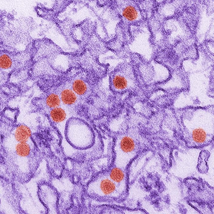 A transmission electron micrograph image of the Zika virus. (Image: Centers for Disease Control and Prevention)