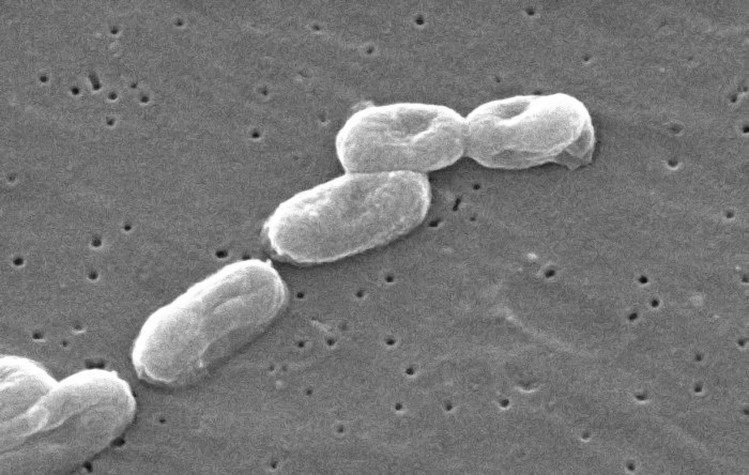 FDA and CDC links B. cepacia outbreak to contamination at PharmaTech