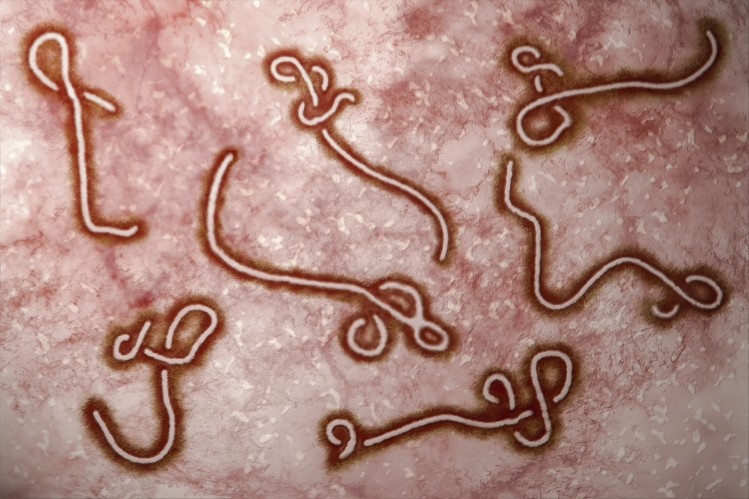 University of Texas has spent seven years developing a nasal spray vaccine against Ebola