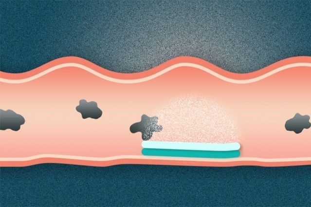 Researchers have created a dual-sided pill that attaches to the gastrointestinal tract. (Illustration: Christine Daniloff/MIT)