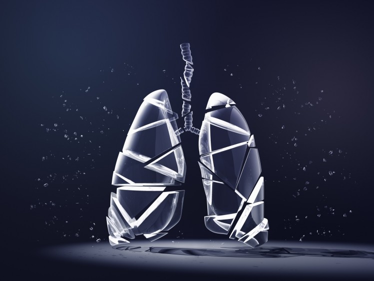 Spectrum Pharmaceuticals had submitted a new drug application (NDA) for the drug candidate as a treatment for patients with previously treated locally advanced or metastatic non-small cell lung cancer.  Image © Hiroshi Watanabe / Getty Images 