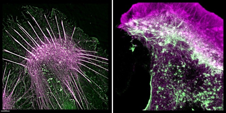 Image shows the purple stained actin within cells and the green colored affimer to which it is bound. The addition of the affimer to the actin inside the cell makes it easier for scientists to study cell behavior, according to a recent report. (Image credit: University of Leeds)