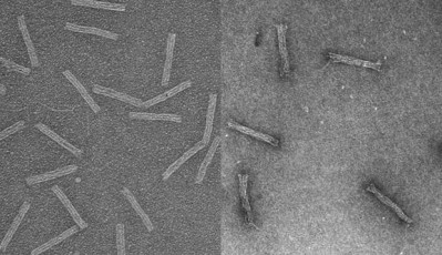 These electron microscope images show the structures empty (left) and loaded with the cancer drug daunorubicin (right). The researchers have demonstrated for the first time that such “DNA origami” structures can be used to treat drug-resistant leukemia cells. Images by Randy Patton, courtesy of The Ohio State University.