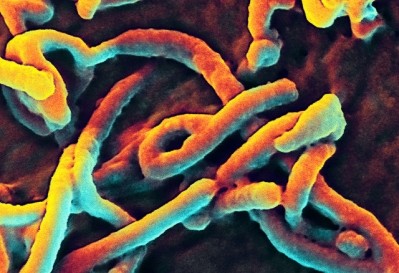 The Ebola virus in an African green monkey. (Image: NIAID)