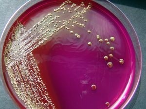 Selcia Gets Cantab Contract to Develop Superbug Busting Antibiotics