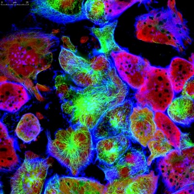 The Human Cancer Models Initiative (HCMI) hopes to create around 1,000 cancer cell models. (Image: iStock/vshivkova)