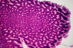 Oncotest adopts 3D cell culturing method